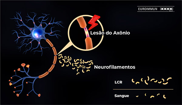 Neurofilamentos de cadeia pesadas (pNf-H) | EUROIMMUN Brasil